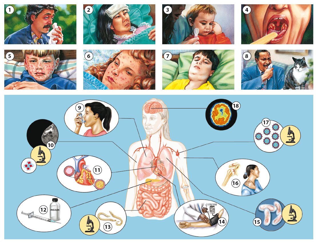 Illnesses and Medical Conditions